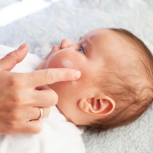 Tiny Case Study A Holistic Approach to Calming Eczema FlareUps